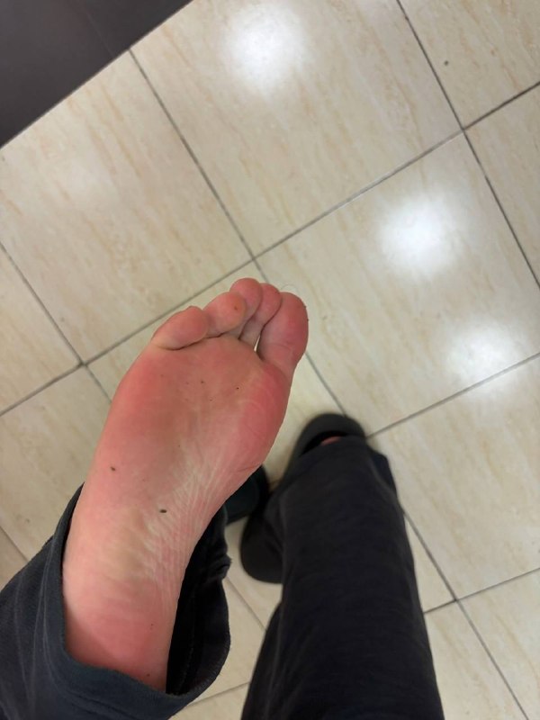 #脚底#脚底