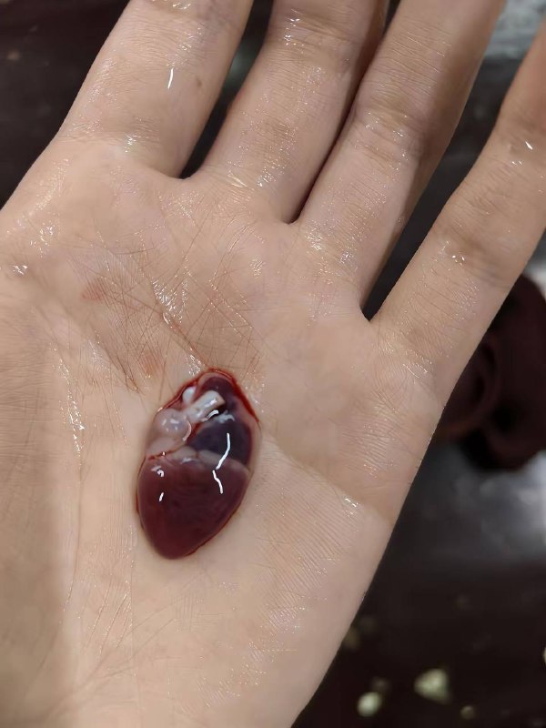人们常常以感叹生命强大而挖开我的心脏人们常常以感叹生命强大而挖开我的心脏