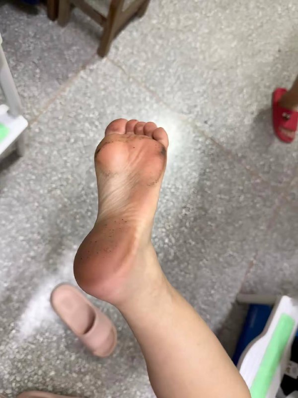 穿拖鞋的后果
